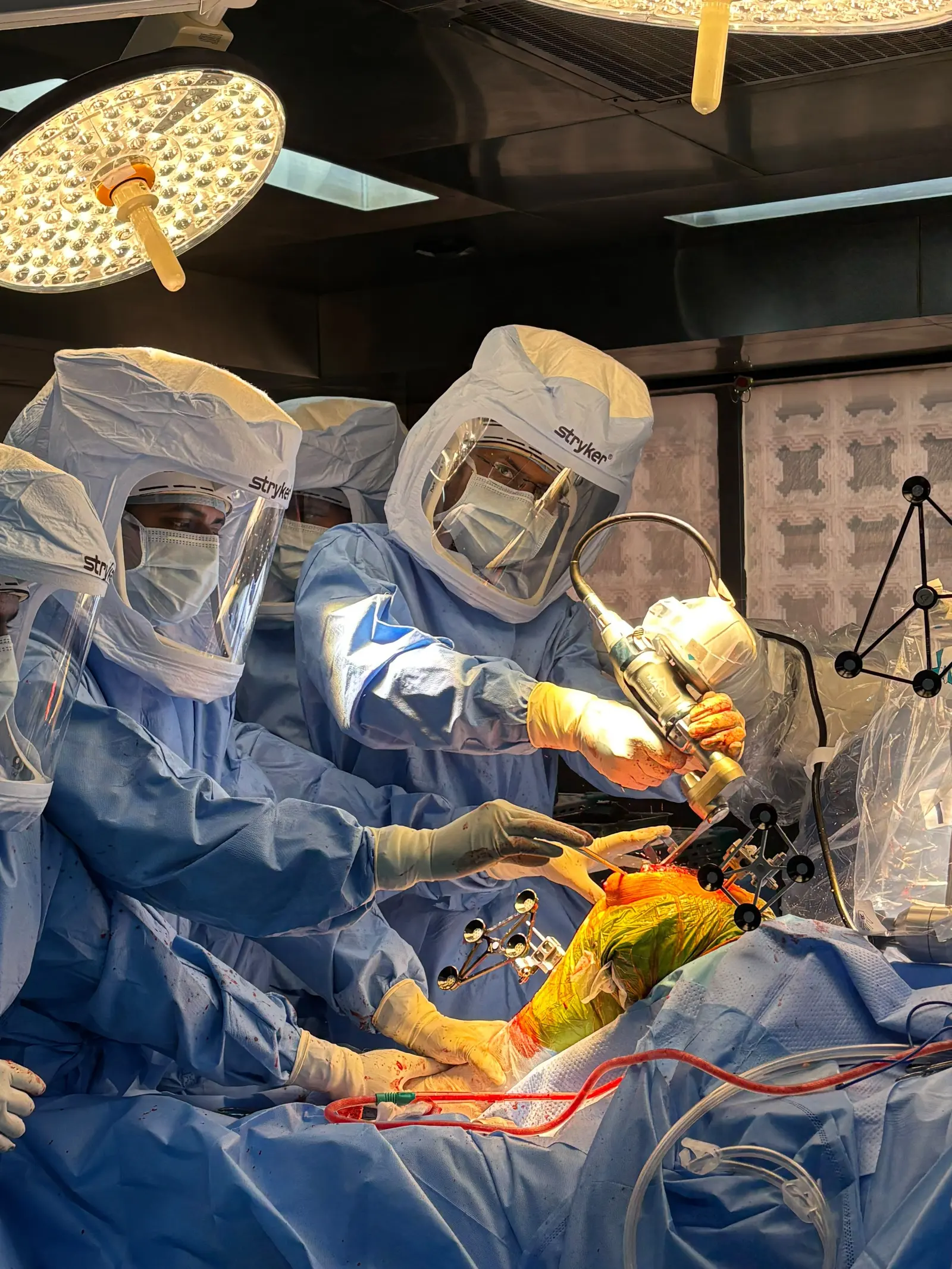 Assisted bone preparation